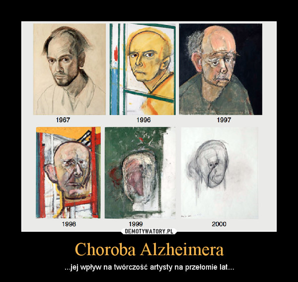 Choroba Alzheimera – ...jej wpływ na twórczość artysty na przełomie lat... 