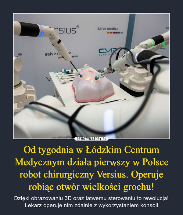 Od tygodnia w Łódzkim Centrum Medycznym działa pierwszy w Polsce robot chirurgiczny Versius. Operuje robiąc otwór wielkości grochu! – Dzięki obrazowaniu 3D oraz łatwemu sterowaniu to rewolucja! Lekarz operuje nim zdalnie z wykorzystaniem konsoli 