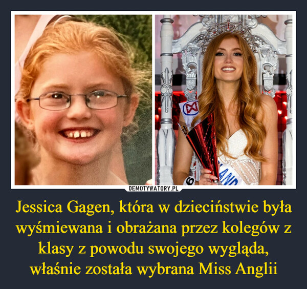 Jessica Gagen, która w dzieciństwie była wyśmiewana i obrażana przez kolegów z klasy z powodu swojego wygląda, właśnie została wybrana Miss Anglii –  