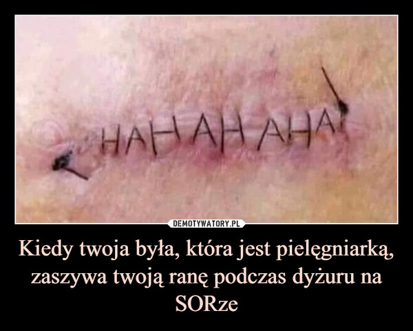 Kiedy twoja była, która jest pielęgniarką, zaszywa twoją ranę podczas dyżuru na SORze –  hahahaha